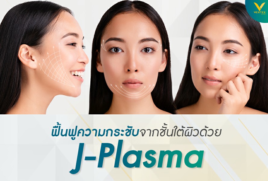 j plasma