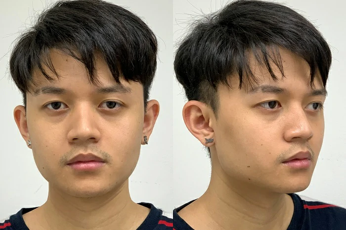 รีวิวตัดกราม