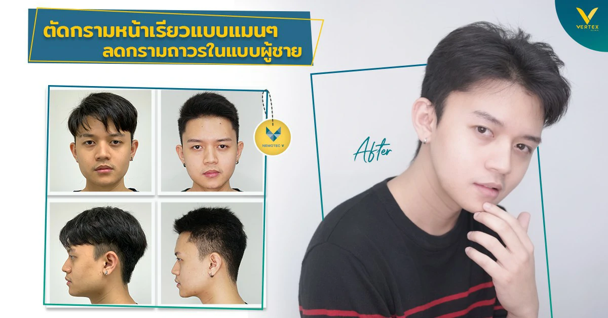ตัดมุมกราม