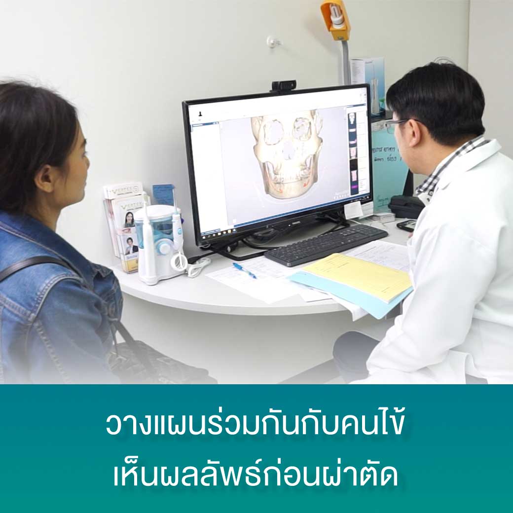เทคนิค Nemotec V