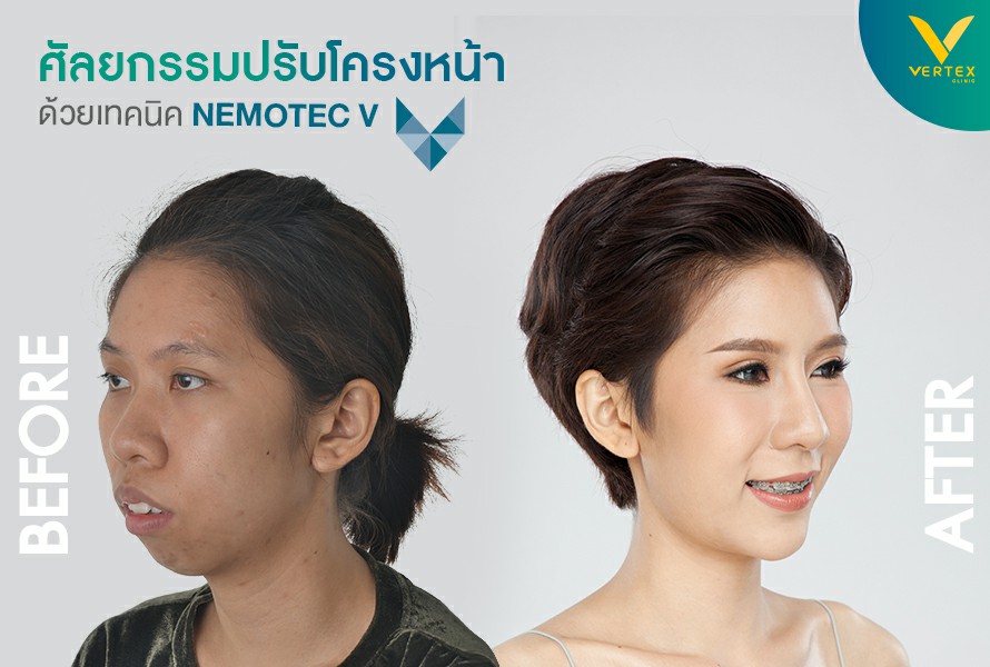 ศัลยกรรมใบหน้า