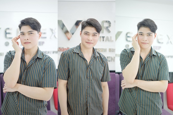รีวิวผ่าตัดขากรรไกร ผ่าขากรรไกร เลื่อนขากรรไกร
