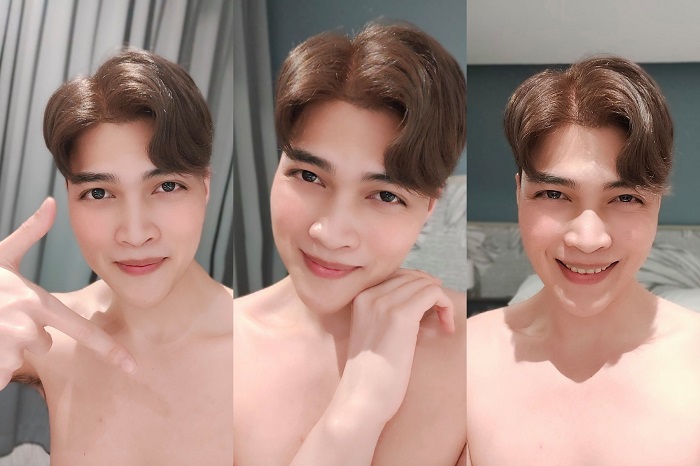 รีวิวผ่าตัดขากรรไกร รีวิวผ่าขากรรไกร เลื่อนขากรรไกร