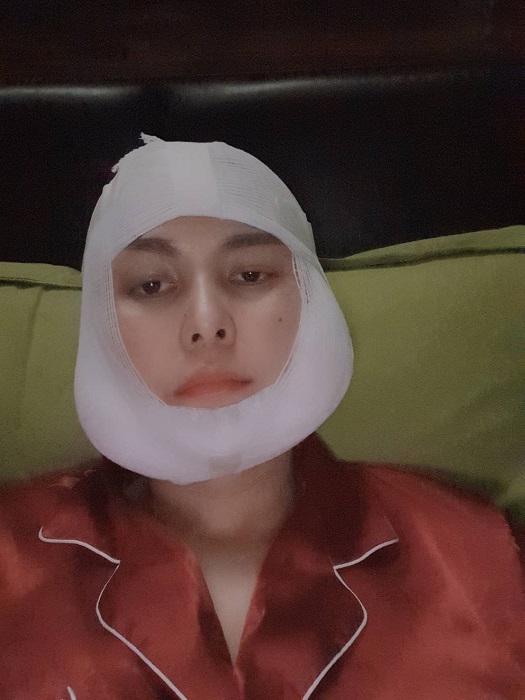 กราม เหลากราม ลดกราม