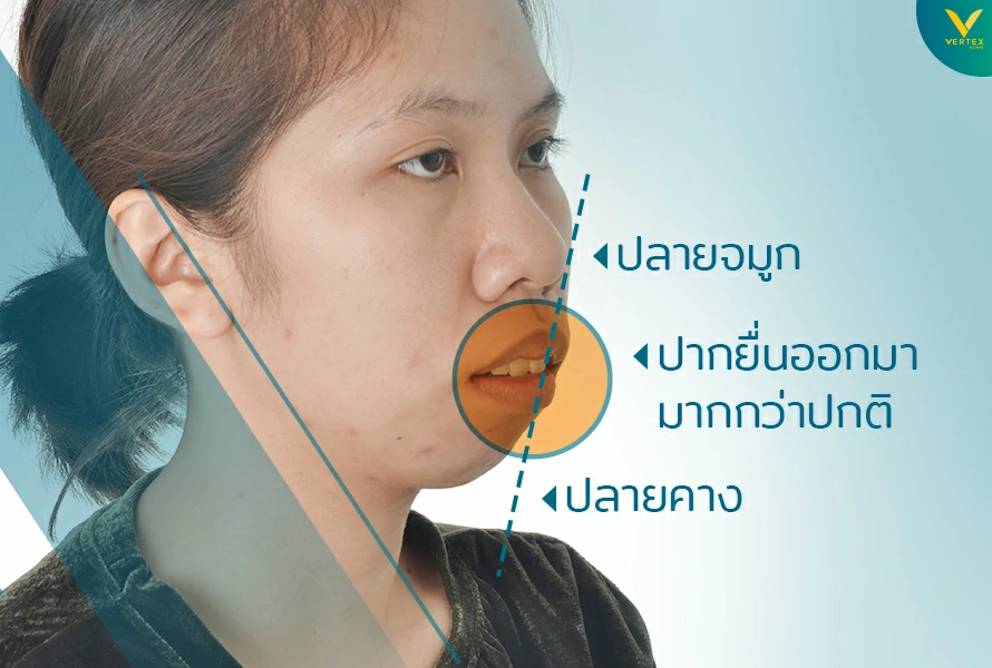 ปากอูมเป็นอย่างไร
