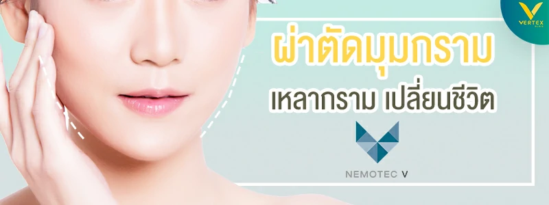 ผ่าตัดกราม ลดกราม เหลากราม ด้วยเทคนิค Nemotec V ผ่าตัดกราม ลดกราม เหลากราม ด้วยเทคนิค Nemotec V