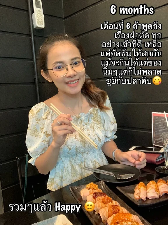 ผ่าขากรรไกร ขากรรไกร ฟันล่างคร่อมฟันบน