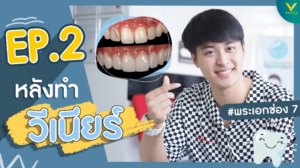 After veneers, you get new teeth.