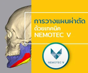 ผ่าตัดขากรรไกร