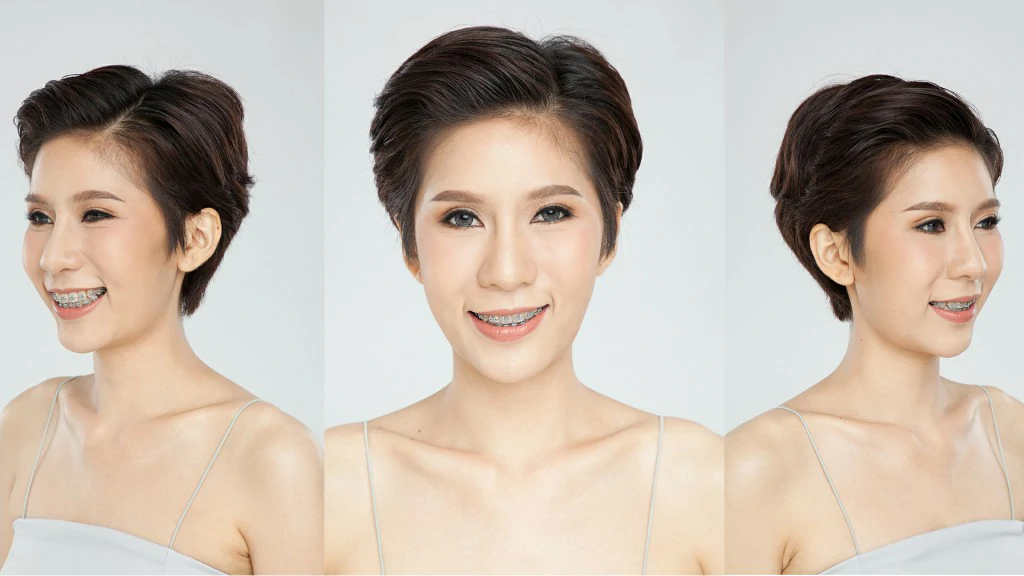 ผ่าตัดขากรรไกร