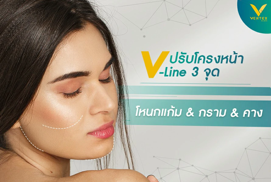 v-line 3
