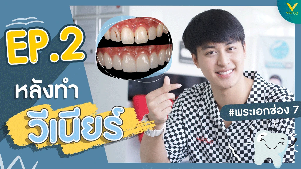 บลิว วรพล ทำวีเนียร์ฟัน แก้ไขฟันที่แตกร้าว คืนรอยยิ้มสวยอย่างมั่นใจ