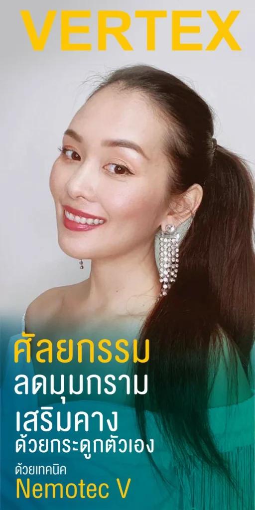ตัดกราม วีไลน์ v line ทำวีไลน์ ศัลยกรรมวีไลน์ มินิวีไลน์