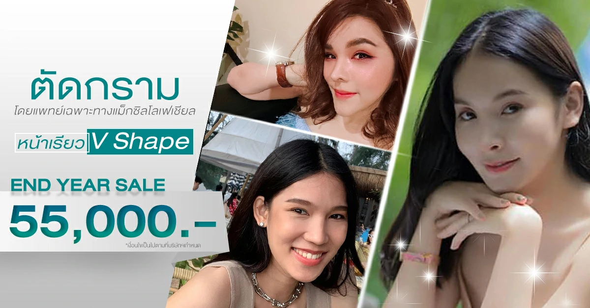 โปรโมชั่นมุมกราม