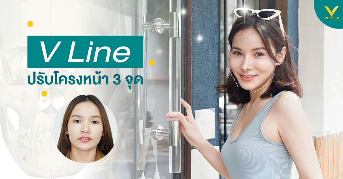 ศัลยกรรมวีไลน์