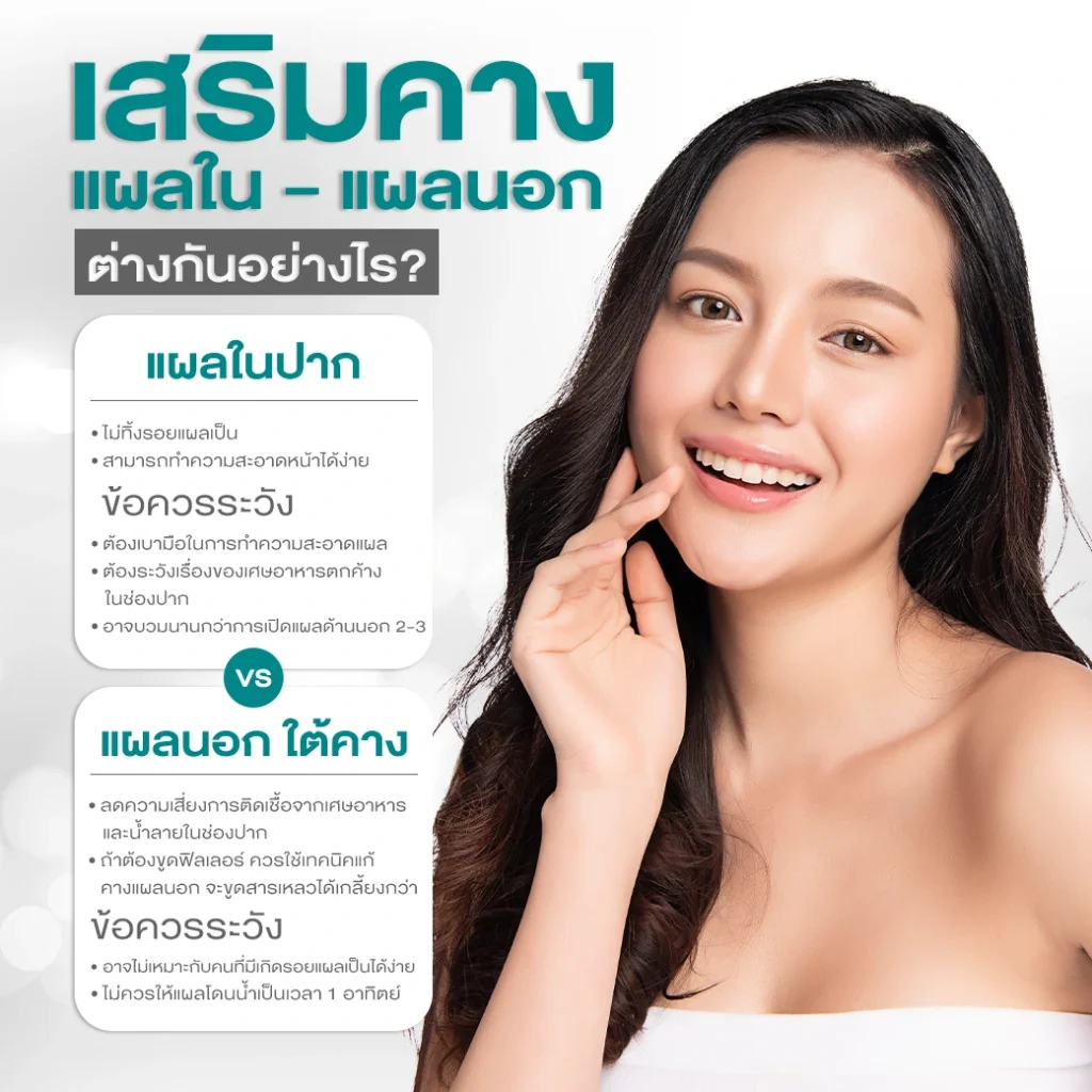 ซิลิโคนเสริมคาง ควรเลือกแบบไหนที่เหมาะกับเรา? ซิลิโคนเสริมคาง ควรเลือกแบบไหนที่เหมาะกับเรา?