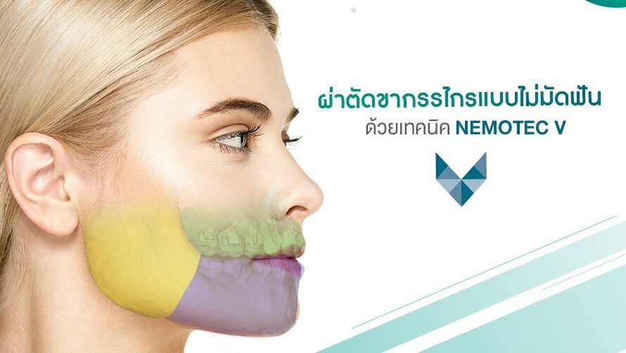 ผ่าขากรรไกรโดยไม่มัดฟัน ด้วย Nemotec V