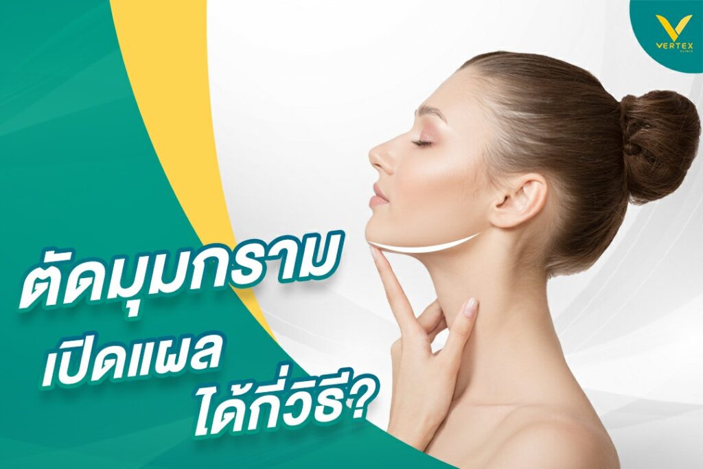 ผ่าตัดมุมกรามมีกี่วิธี