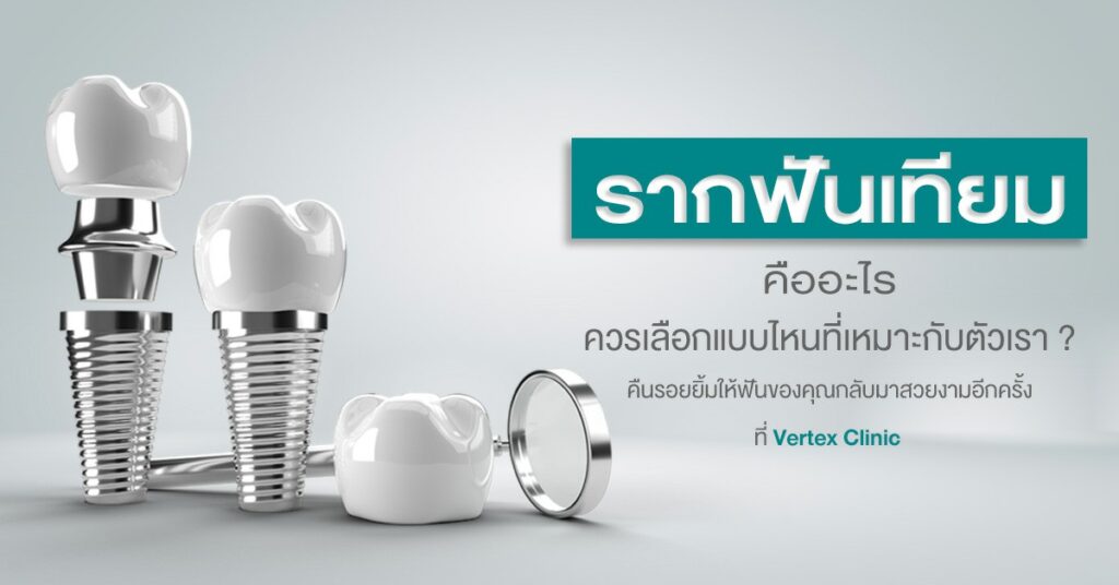 รากฟันเทียมคืออะไร ควรเลือกแบบไหนที่เหมาะกับตัวเรา?