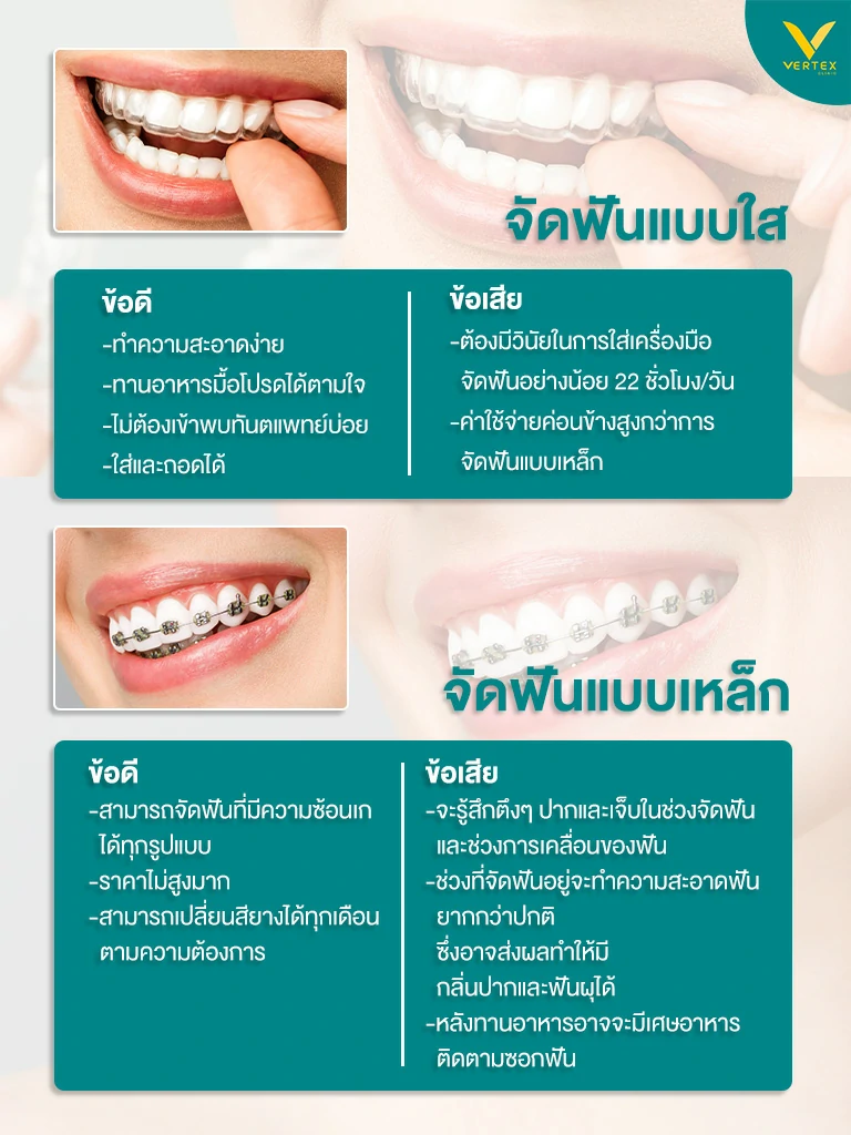 จัดฟันครั้งแรกกี่บาท จัดฟันครั้ง แรกราคา