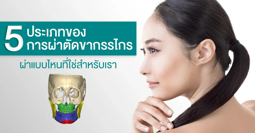 ผ่าตัดขากรรไกร ขากรรไกร ผ่าขากรรไกร ฟันไม่สบกัน