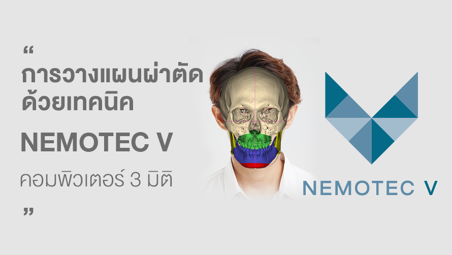ผ่าตัดขากรรไกร-การวางแผนผ่าตัด