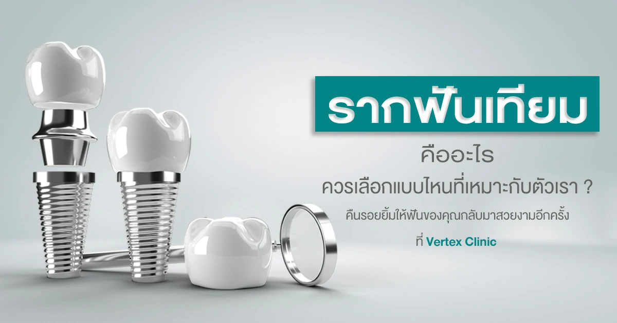 รากฟันเทียมคืออะไร ควรเลือกแบบไหนที่เหมาะกับตัวเรา?