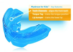 Myobrace ขากรรไกรยื่น