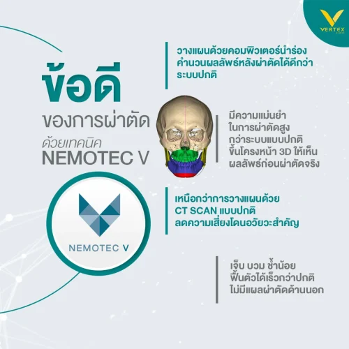 เสริมคางด้วยกระดูกตัวเอง วางแผนด้วยระบบคอมพิวเตอร์ ผ่าตัดโดยเทคนิคเฉพาะ