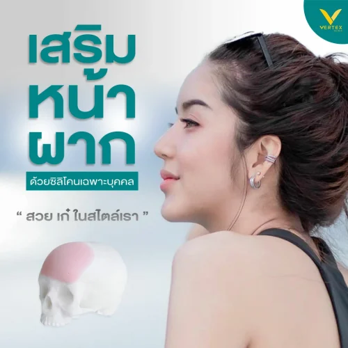รีวิวเสริมหน้าผาก รีวิวศัลยกรรมหน้าผาก รีวิวทำหน้าผาก เสริมหน้าผาก ศัลยกรรมหน้าผาก ทำหน้าผาก