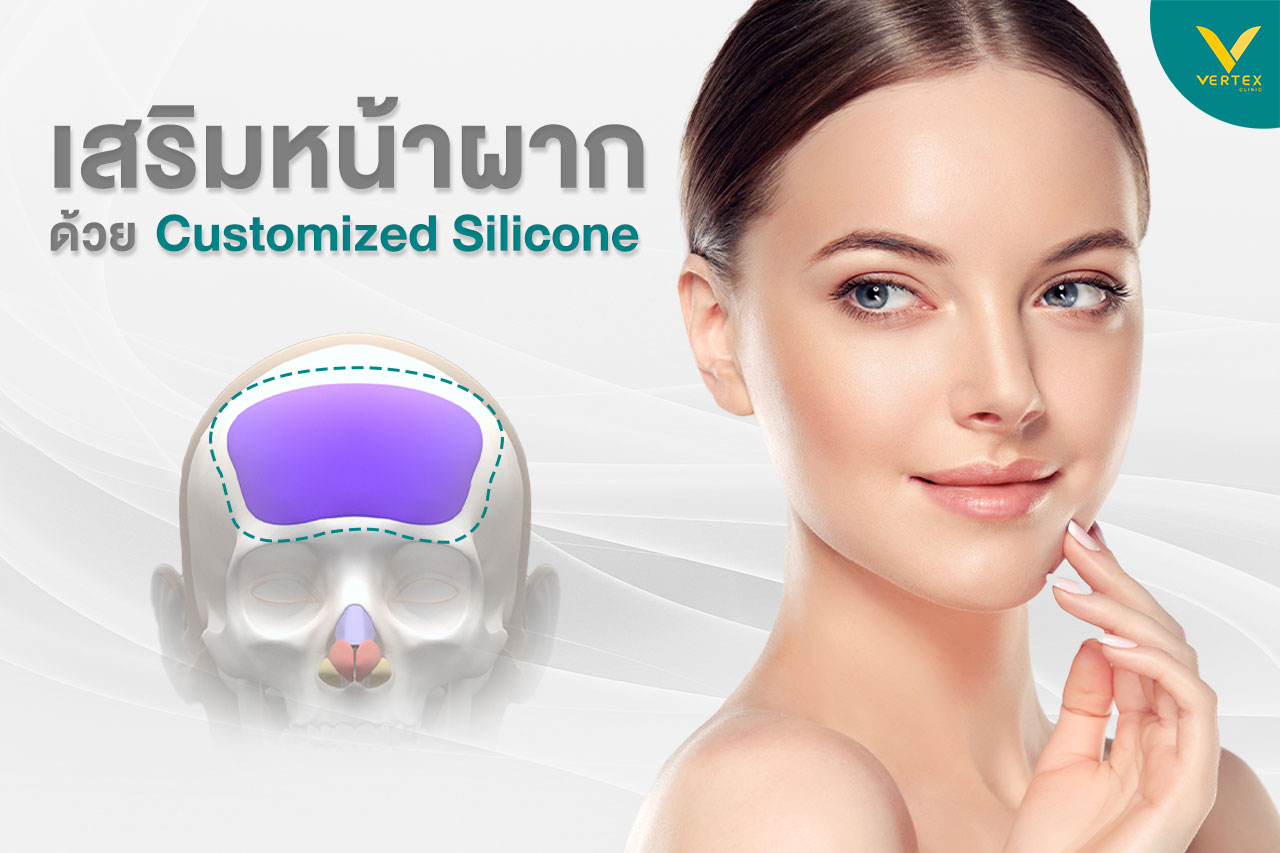 ศัลยกรรมหน้าผาก เสริมหน้าผากซิลิโคน ทำหน้าผากนูนสวย บอกลาหน้าผากแบน
