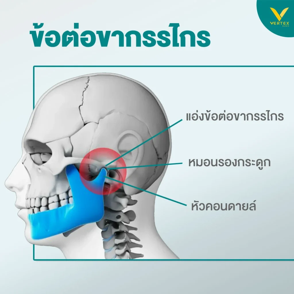 ขากรรไกรผิดปกติ หน้าที่ข้อต่อขากรรไกร
