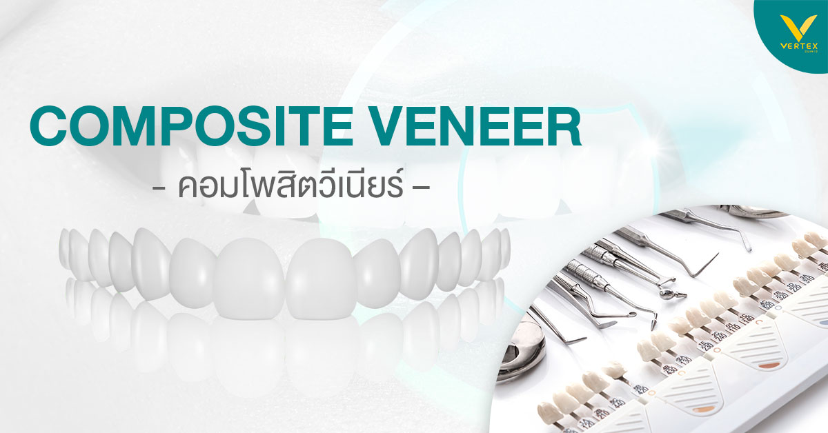 Composite Veneer