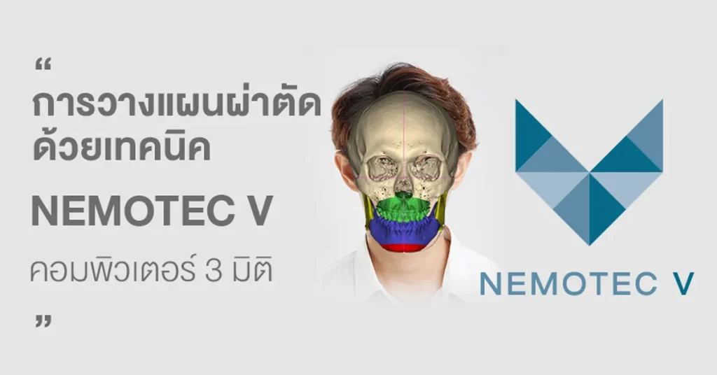 NEMOTEC V คืออะไร
