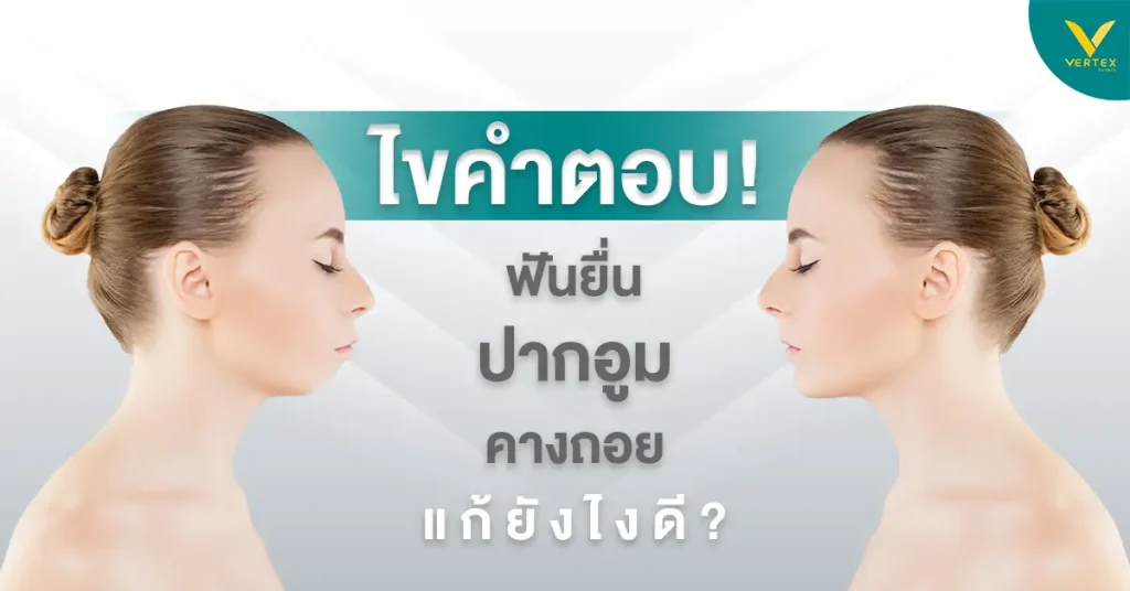 ปากบนยื่น ฟันยื่น ปากอูม ข้อควรรู้