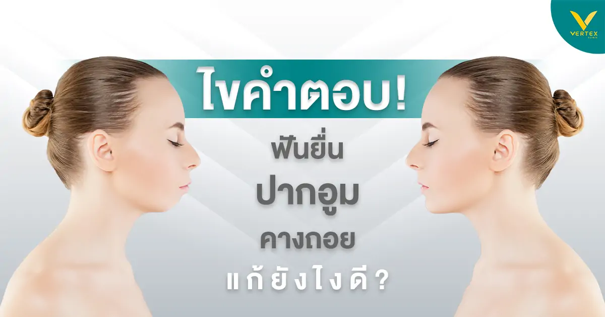 ปากบนยื่น ฟันยื่น ปากอูม ข้อควรรู้