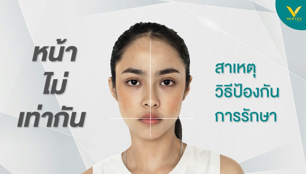 ปรับรูปหน้าให้เท่ากัน รักษาใบหน้าไม่เท่ากัน