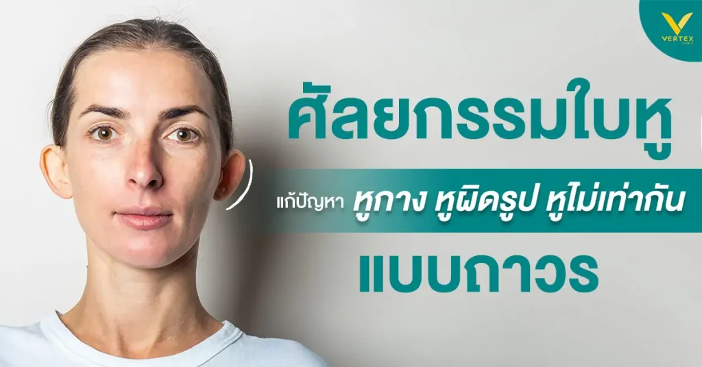 หูไม่เท่ากัน วิธีแก้หูกางด้วยการผ่าตัดหูกาง