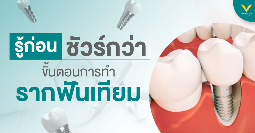 ขั้นตอนการทำรากฟันเทียม ทันตกรรมรากฟันเทียม การใส่รากฟันเทียม