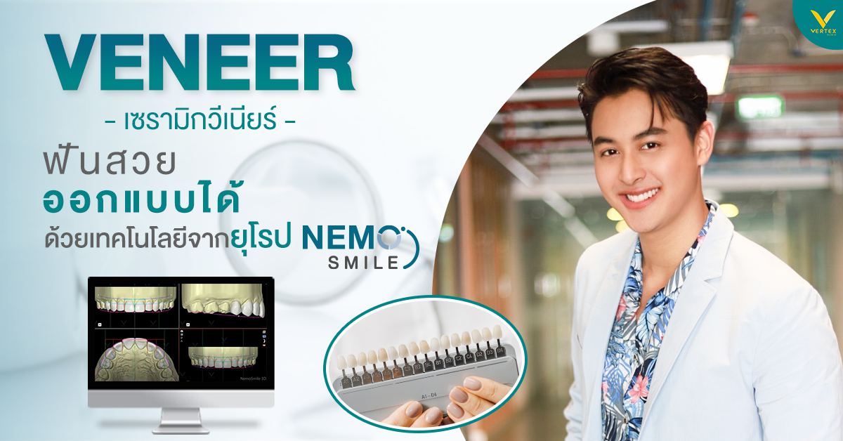 วีเนียร์ เคลือบฟันขาว แปะฟันขาว (Veneer)