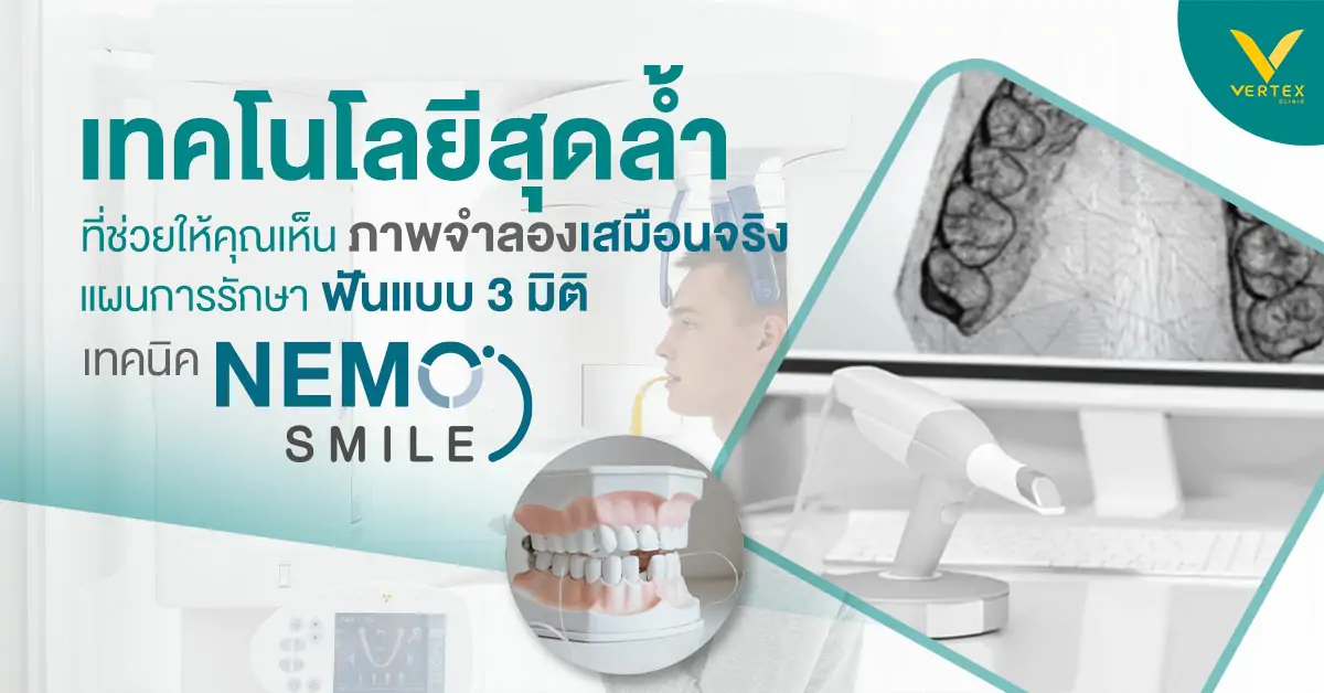 เทคโนโลยีสุดล้ำ Vertex Dental
