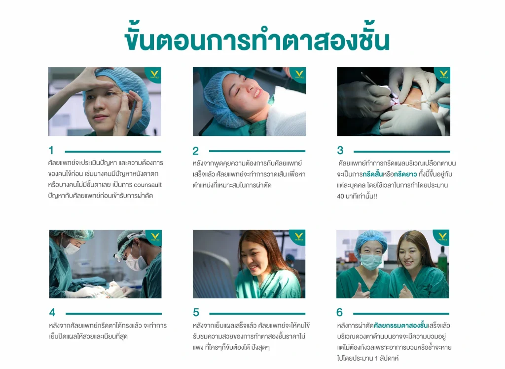 รีวิวทำตา 2 ชั้น - โปรทำตาสองชั้นราคาถูก