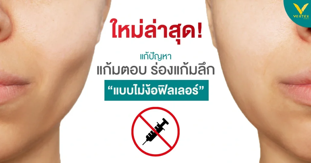 แก้มตอบ แก้มแบน แก้แบบไม่ฉีดฟิลเลอร์