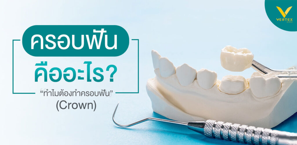 ครอบฟัน-การครอบฟัน