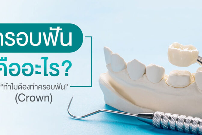 ครอบฟันคืออะไร? ทำไมต้องทำครอบฟัน (Crown)