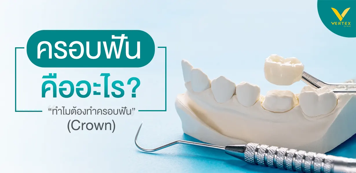 ครอบฟัน-การครอบฟัน