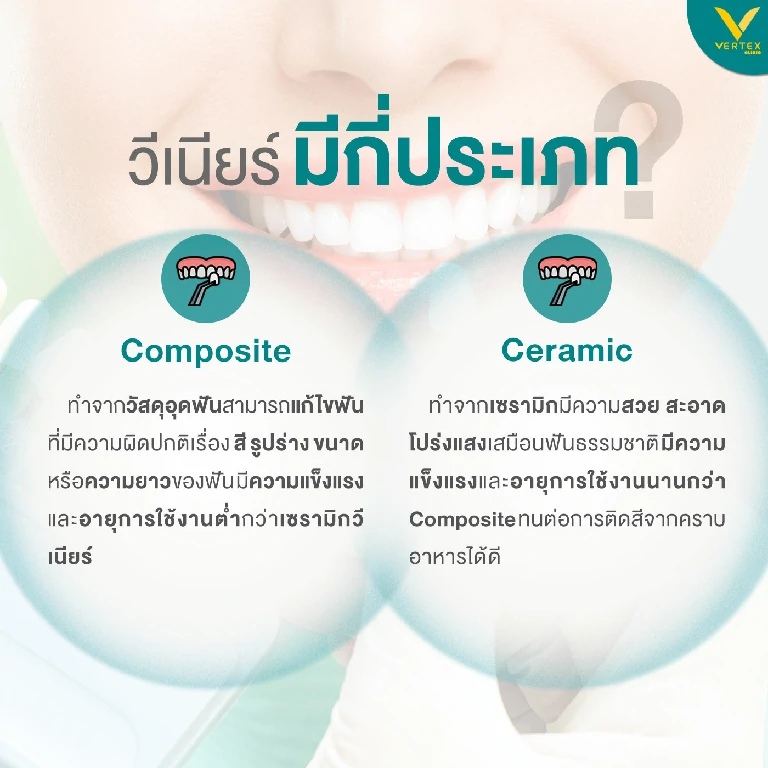 ประเภทของวีเนียร์