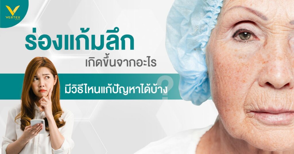 ร่องแก้มลึกเกิดจากอะไร