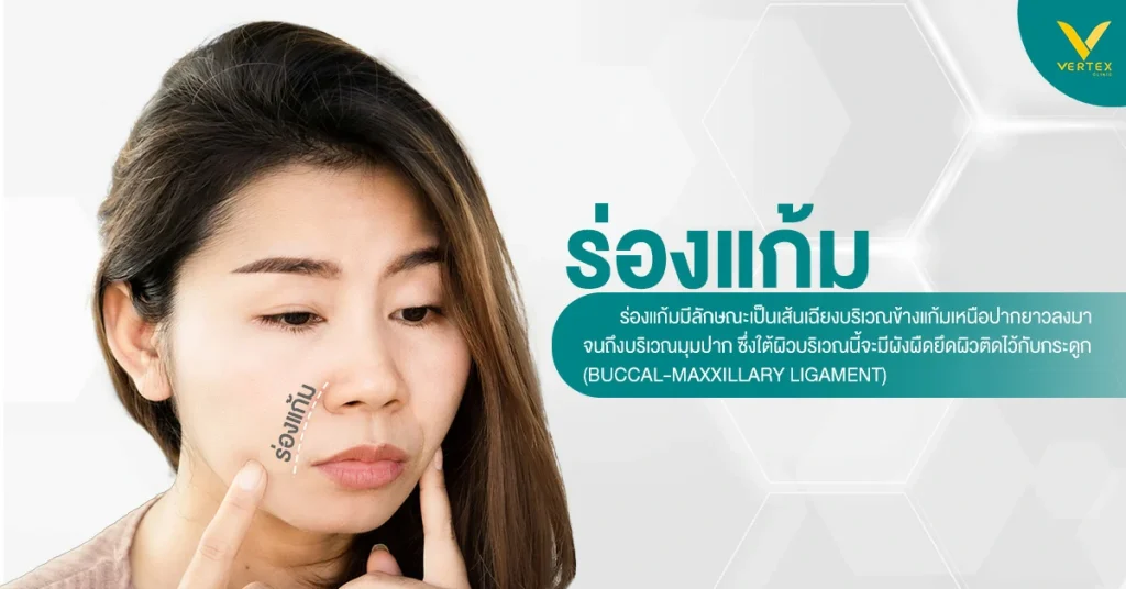 ร่องแก้มลึกคืออะไร