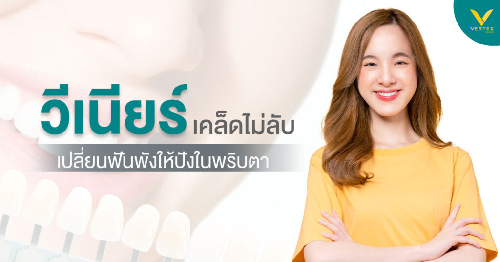 วีเนียร์คืออะไร